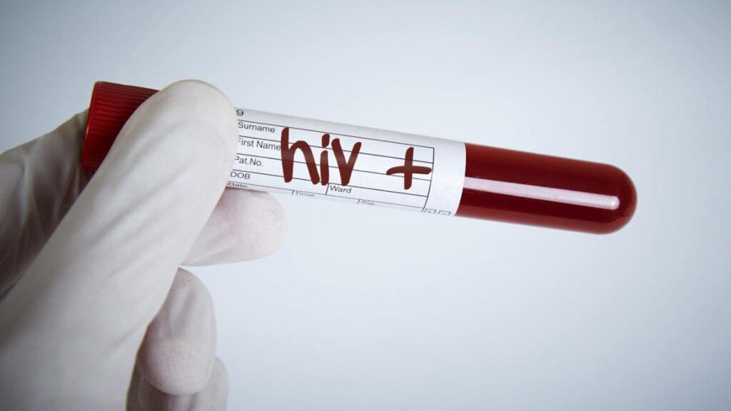 Quem tem HIV pode se aposentar? Conheça seus benefícios