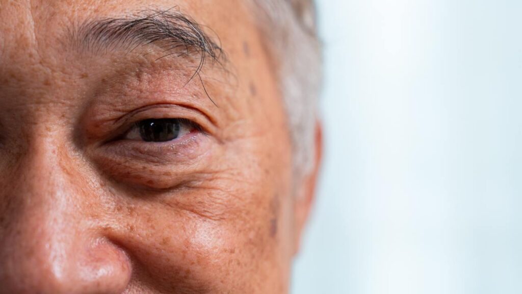 aposentadoria visão monocular