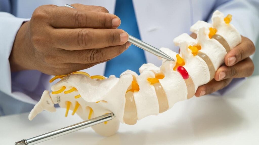 Aposentadoria por espondilite anquilosante